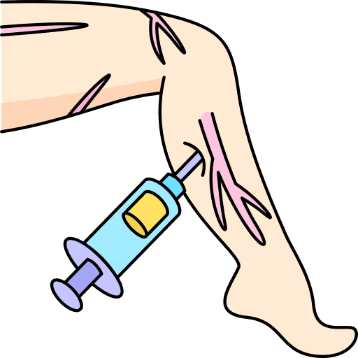 Varicose Veins